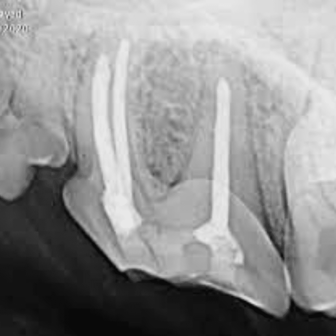 imaging of tooth roots